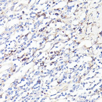 IL6 / Interleukin 6 Antibody
