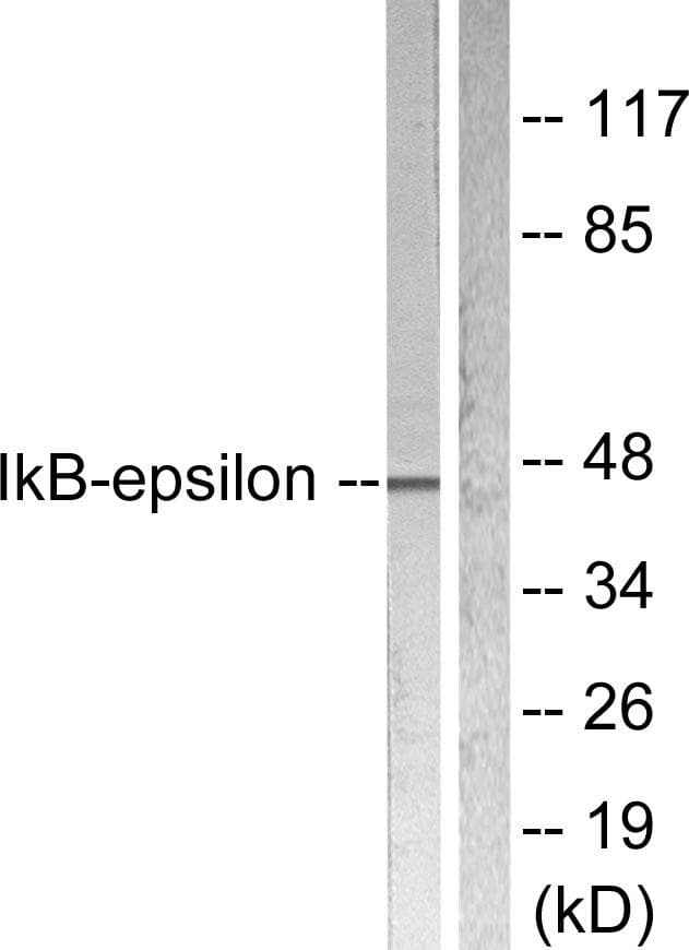 Polyclonal Rabbit anti-Human NFKBIE / IKB Epsilon Antibody (p22, IHC, IF, WB)