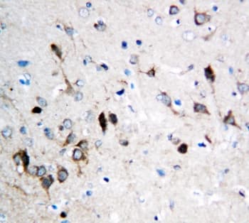 GRIN1 / NMDAR1 Antibody (aa36-53)