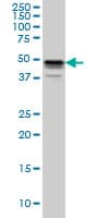 MKNK1 / MNK1 Antibody (clone 3E1)