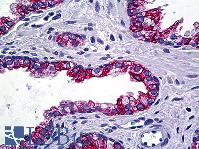 PathPlus™ KRT4 / CK4 / Cytokeratin 4 Antibody (clone 5H5)