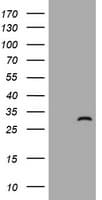 ZFYVE21 Antibody (clone OTI2B12)