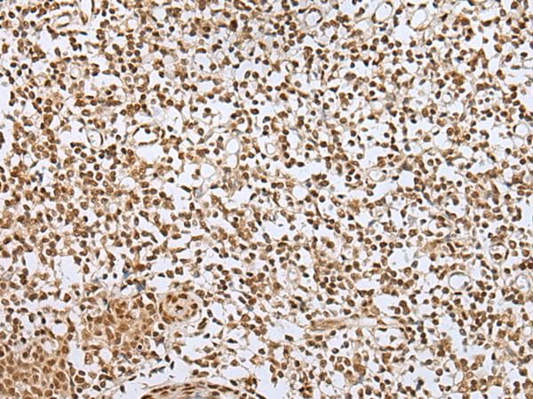 Polyclonal Rabbit anti-Human ZNF354A Antibody (IHC)