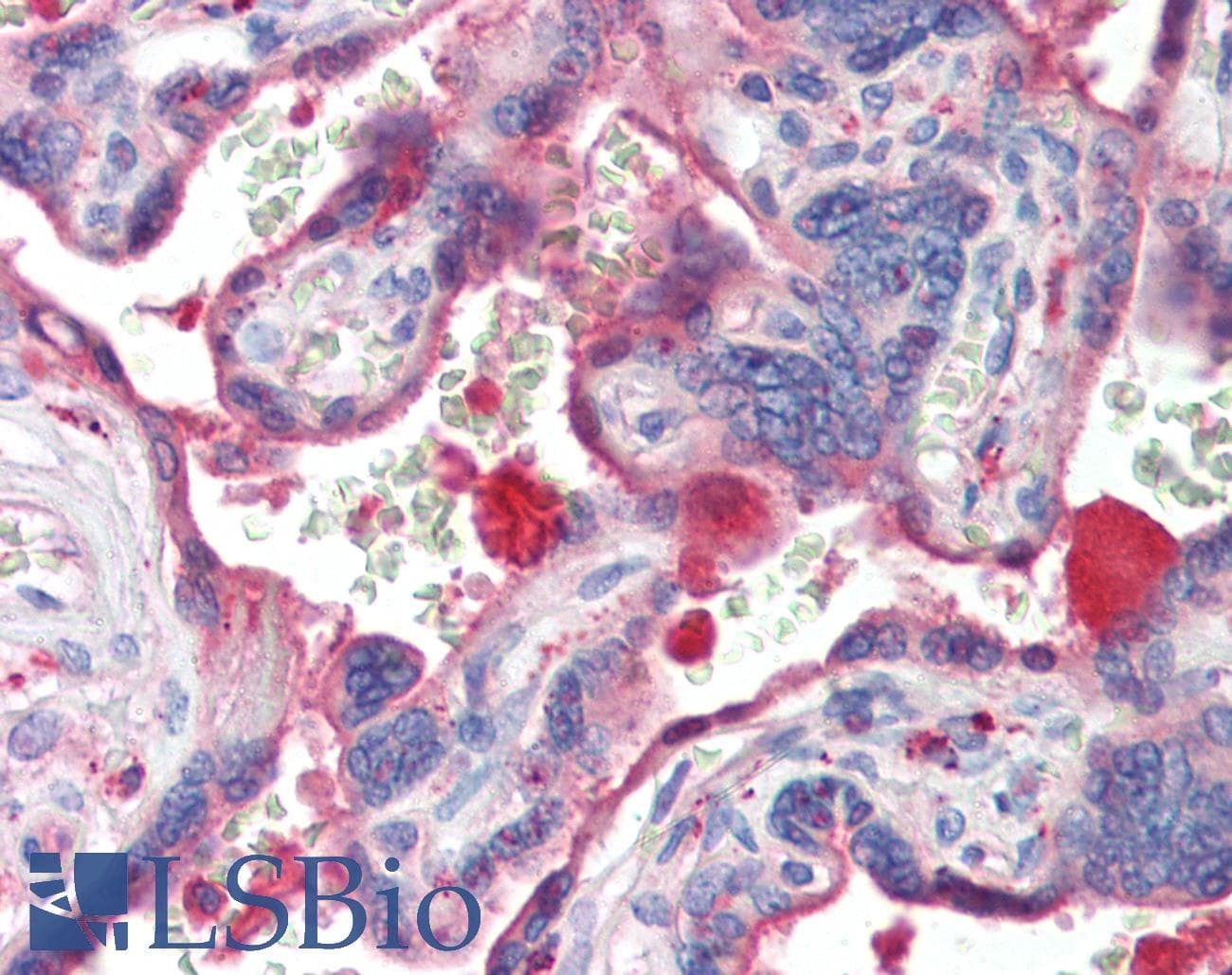 IHC-plus™ CTSL / Cathepsin L Antibody