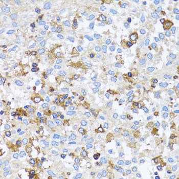 Polyclonal Rabbit anti-Human ACTR2 / ARP2 Antibody (IHC, IF, WB)
