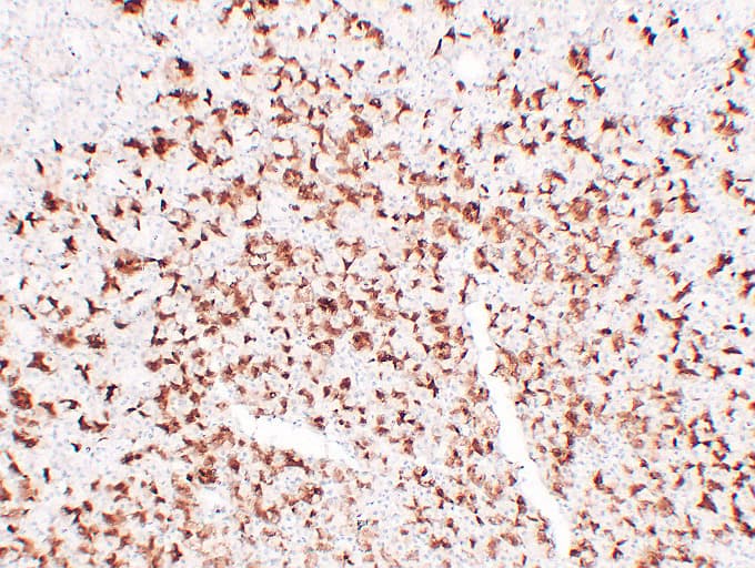 MUC6 / MUC-6 Antibody (clone ABT-MUC6)