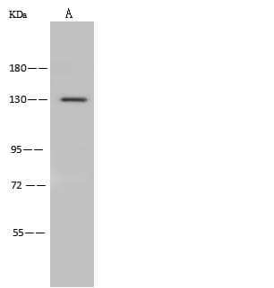 Polyclonal Rabbit anti-Mouse ADAMTS10 Antibody (Preservative Free, WB)