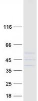 Human SFXN3 / Sideroflexin 3 Protein (Recombinant Myc-DDK (Flag))