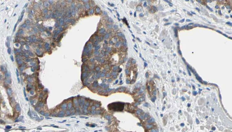 Polyclonal Rabbit anti-Human CBR / CBR1 Antibody (IHC, IF, WB)