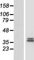 CHST13 Protein (Over-Expression Lysate Myc-DDK (Flag))