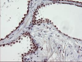 UBE2E3 Antibody (clone OTI7E8)