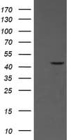 MAP2K1 / MKK1 / MEK1 Antibody (clone OTI5A11)