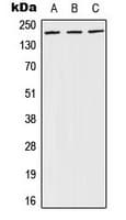 Polyclonal Rabbit anti-Human BRCA1 Antibody (phospho-Ser1524, IHC, WB)