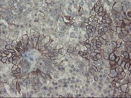DPH2 Antibody (clone OTI3A12)