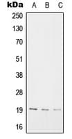 SNX3 Antibody (Internal)