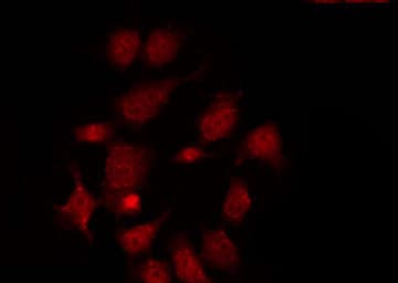 ARHGAP17 / NADRIN Antibody