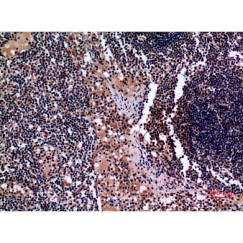 KRT19 / CK19 / Cytokeratin 19 Antibody (321-370 aa, C-terminal)