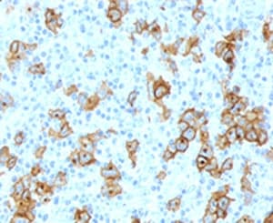 CD30 Antibody (clone Ki-1/779)