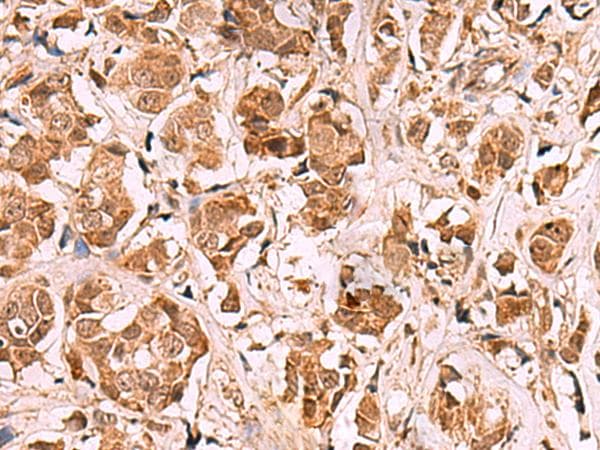 RRP8 Antibody