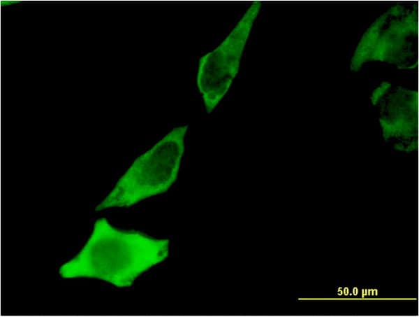 BDNF Antibody (clone 1B10)