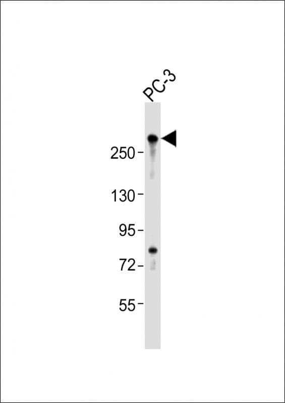 Polyclonal Rabbit anti-Human RLF Antibody (aa1751-1785, WB)