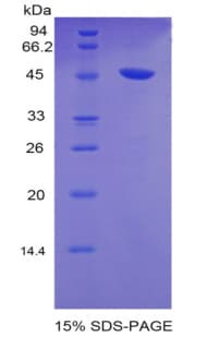 Pig F8 / FVIII / Factor VIII Protein (Recombinant His)