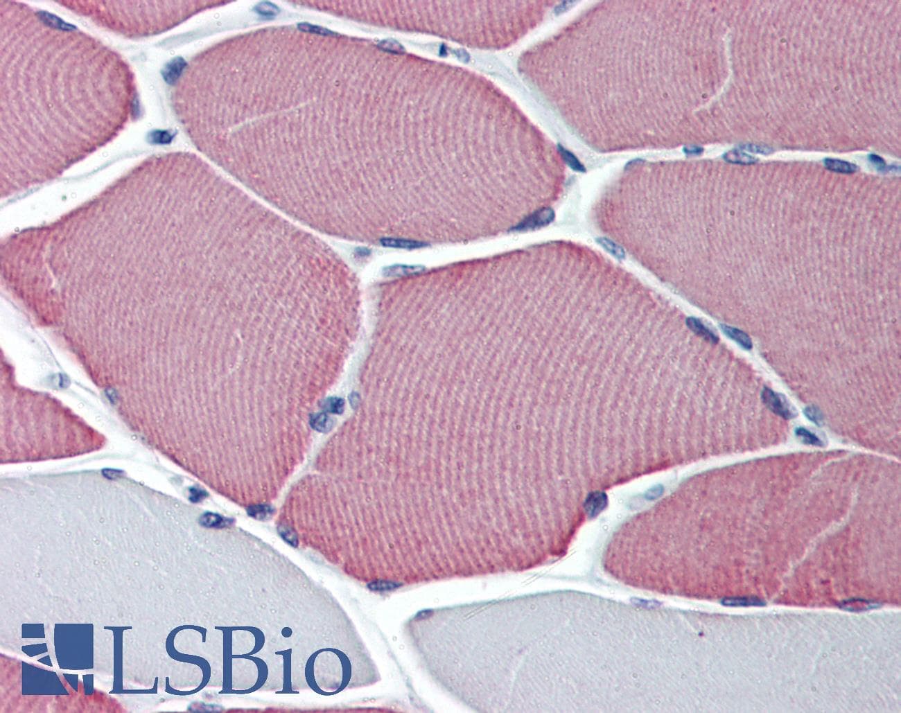 IHC-plus™ TNNC1 / Cardiac Troponin C Antibody (clone 1F8-A9)
