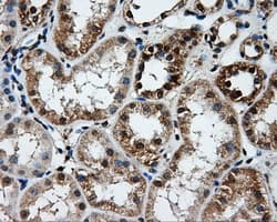 KIAA0153 / TTLL12 Antibody (clone OTI1A2)