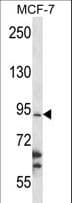 RBM28 Antibody (aa62-91)