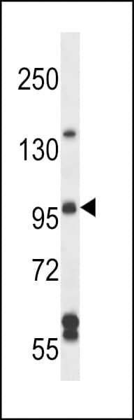 Polyclonal Rabbit anti-Human ARHGEF26 / SGEF Antibody (aa378-406, IHC, WB)