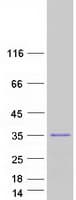 Human ZC2HC1B / FAM164B Protein (Recombinant Myc-DDK (Flag))