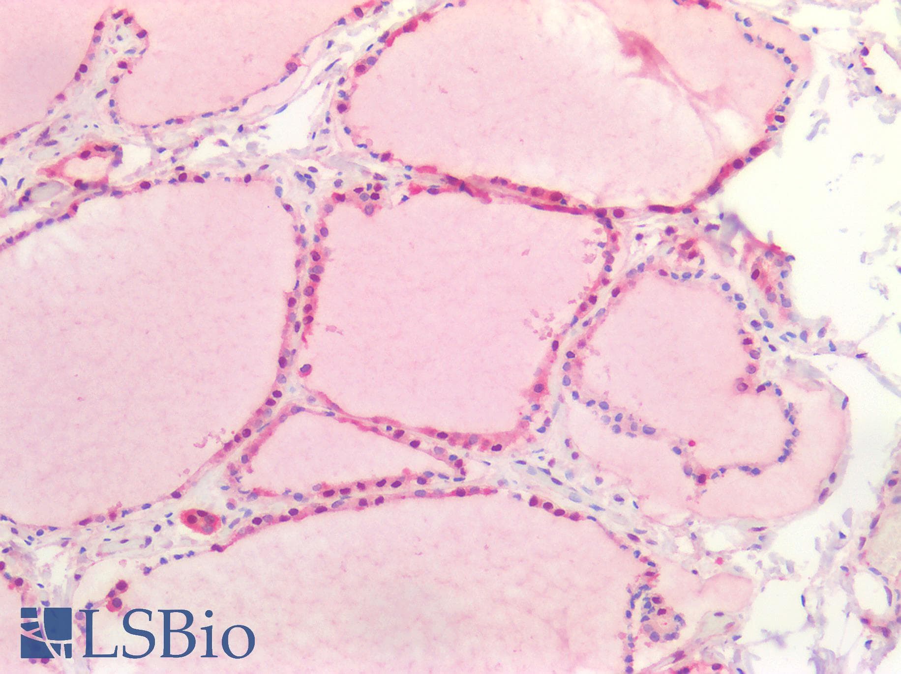 IHC-plus™ Polyclonal Rabbit anti-Human PARK7 / DJ-1 Antibody (IHC, IF, WB)