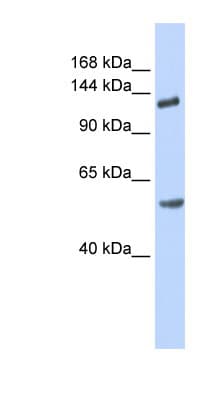 ROBO2 Antibody (aa252-301)