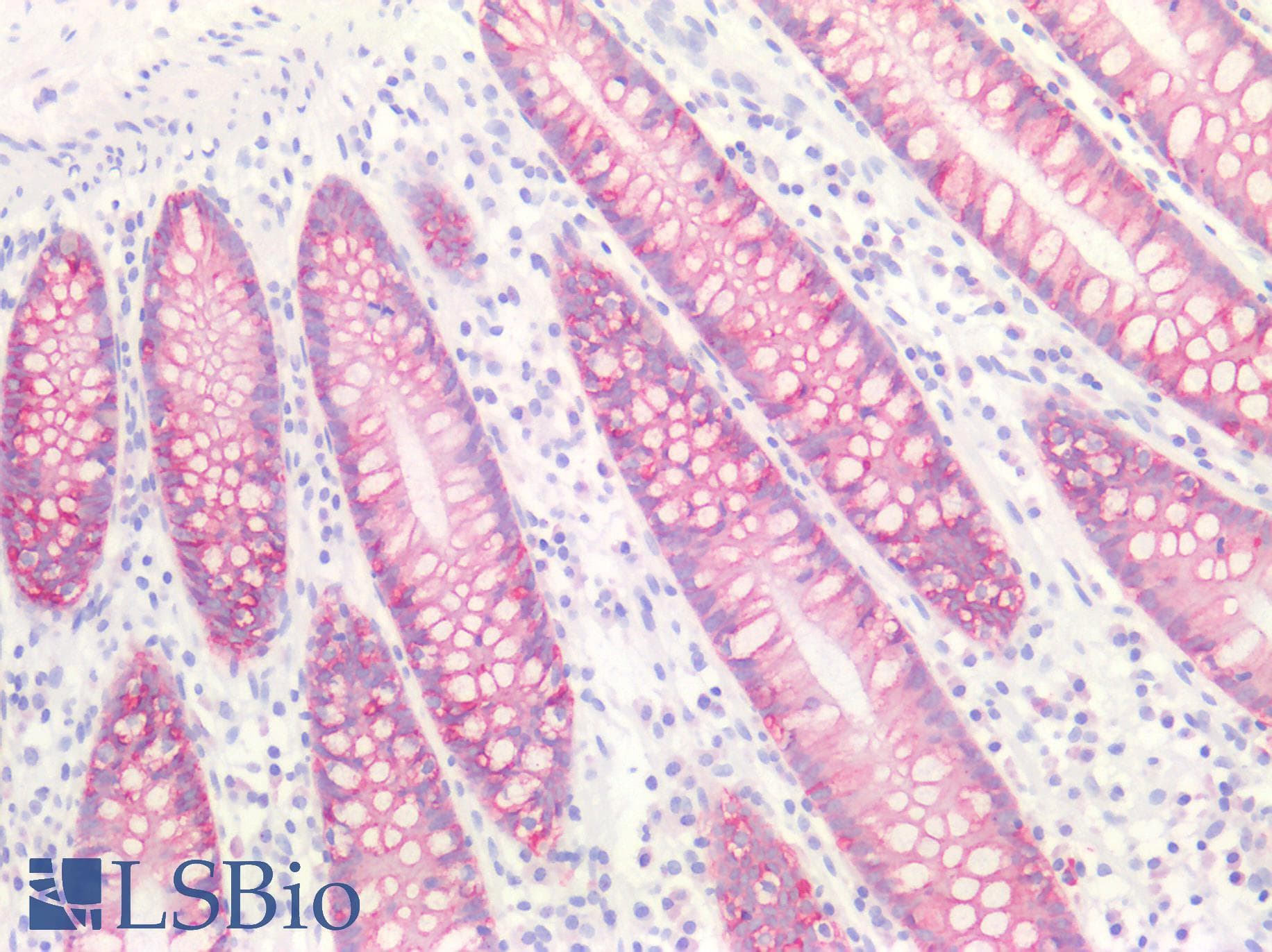 PathPlus™ CLDN4 / Claudin 4 Antibody (aa160-209)