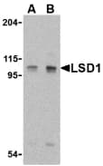 IHC-plus™ Polyclonal Rabbit anti-Human KDM1A / LSD1 Antibody (IHC, IF, WB)