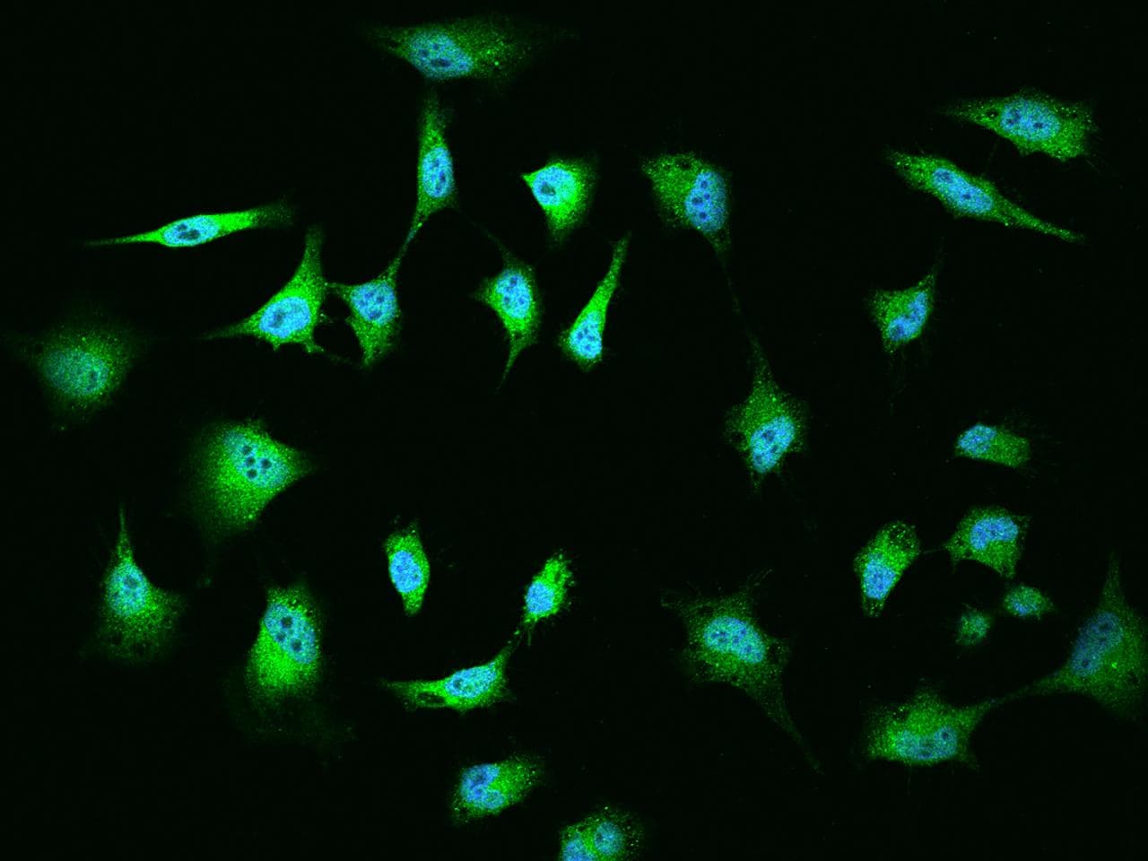 MGA / MAD5 Antibody