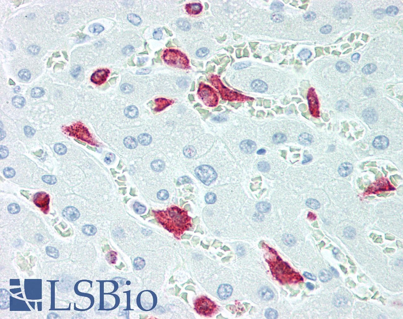 PathPlus™ Monoclonal Mouse anti-Human CD163 Antibody (IHC)