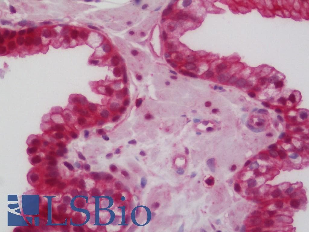 IHC-plus™ Polyclonal Rabbit anti-Human CAMKK2 Antibody (aa374-423, IHC, WB)
