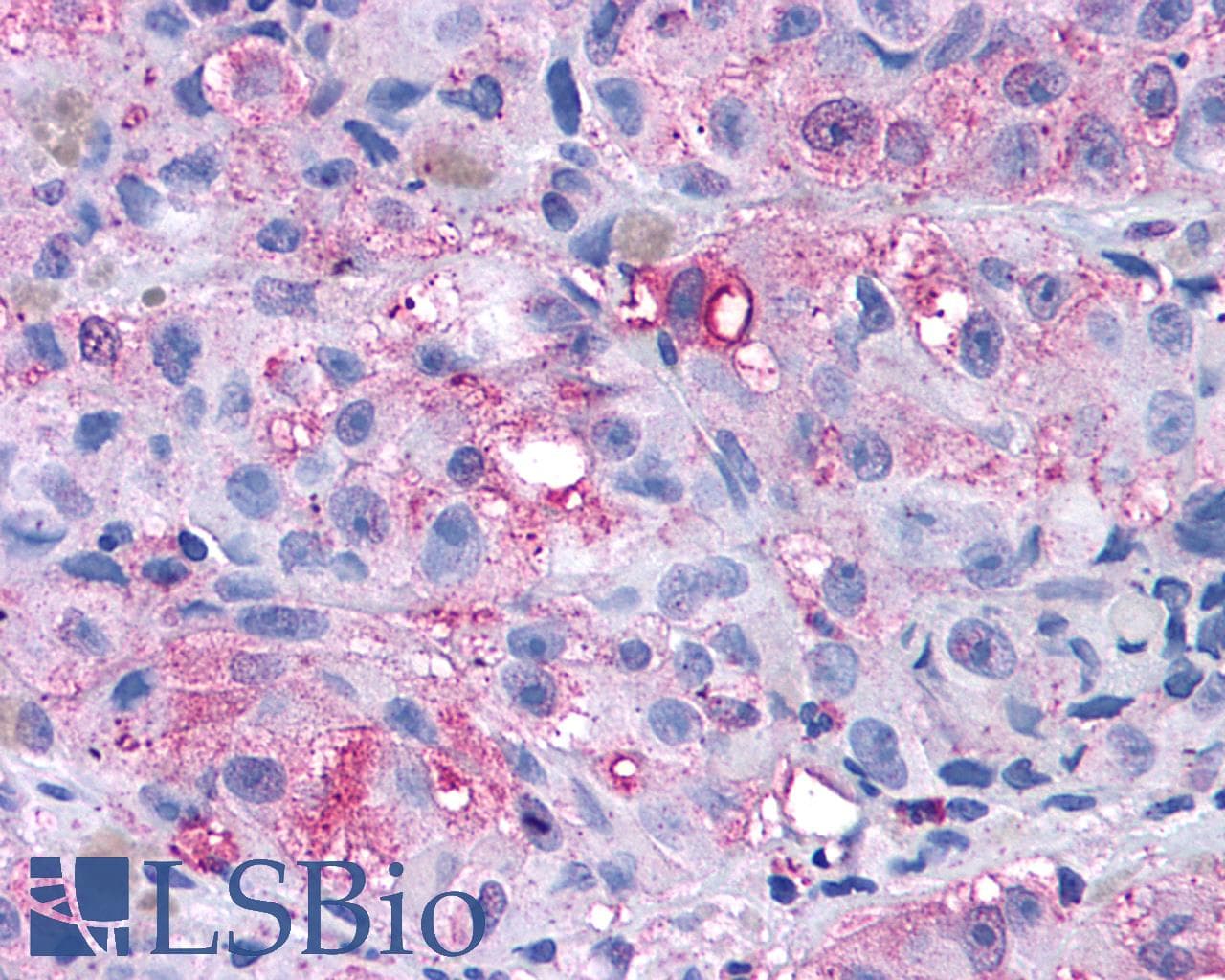 PathPlus™ GRM4 / MGLUR4 Antibody (N-Terminus)