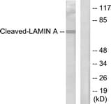 Polyclonal Rabbit anti-Human LMNA / Lamin A+C Antibody (aa181-230, IHC, WB)