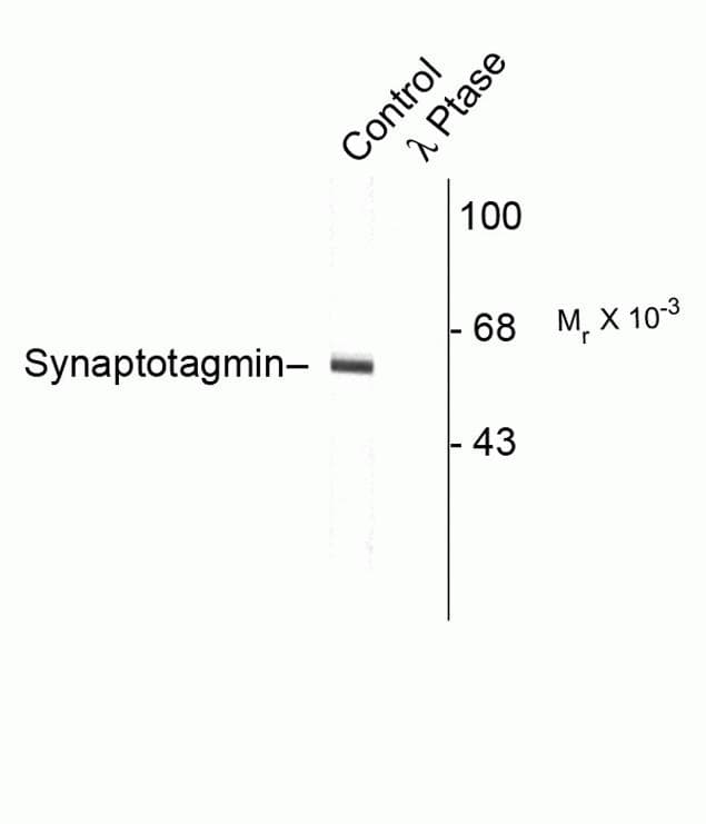Synaptotagmin Antibody (phospho-Thr202)