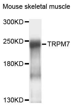 Polyclonal Rabbit anti-Human TRPM7 Antibody (WB)