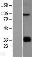 Human TLR5 Protein (Over-Expression Lysate Myc-DDK (Flag))