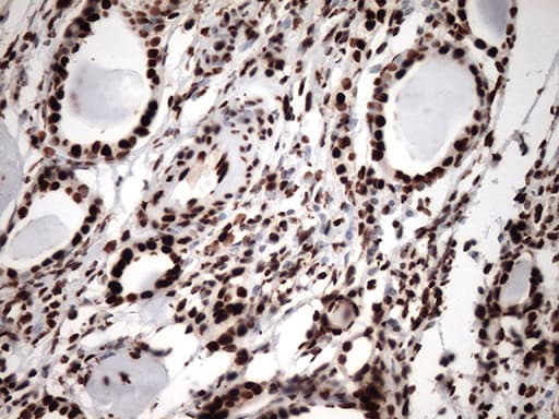 TRIM28 / KAP1 Antibody (clone OTI9F4)