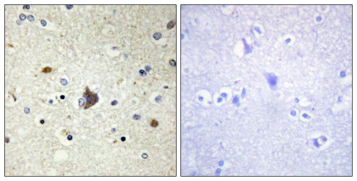Polyclonal Rabbit anti-Human COL4A3 / Tumstatin Antibody (aa801-850, IHC, IF)