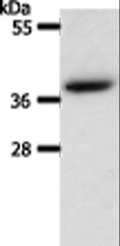 AKR1B1 / Aldose Reductase Antibody