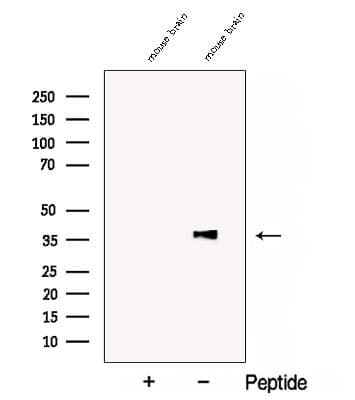 COQ5 Antibody