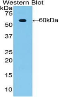 EMA / MUC1 Antibody (aa404-655)