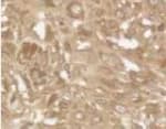 BBC3 / PUMA Antibody