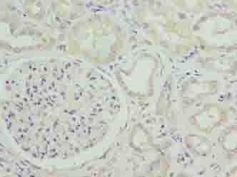 SUSD6 / KIAA0247 Antibody
